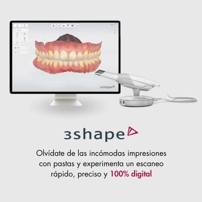 escaner-intraoral-sant-mateu